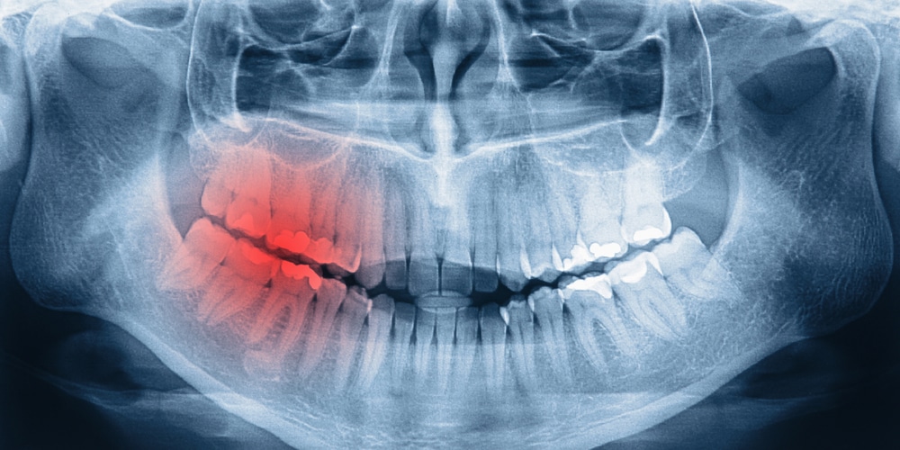 5-common-signs-of-more-serious-dental-problems-carlingwood-dental